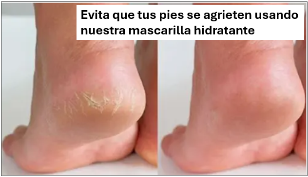 Mascarilla Hidratante para Pies
